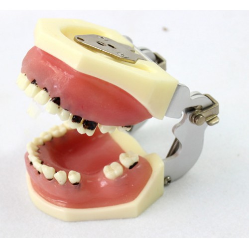 歯周病教学・説明用模型最安值通販|歯科説明・実習用模型-Dentalshop.JP