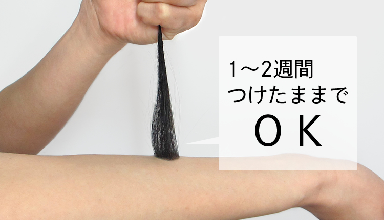 円形脱毛、傷跡を増毛 | どこでもくん