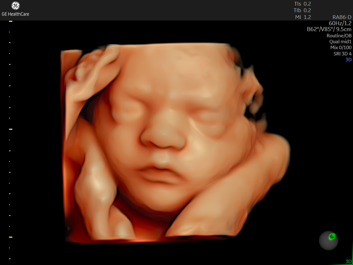 クリニックに導入している医療機器｜ゆうレディースクリニック東小金井