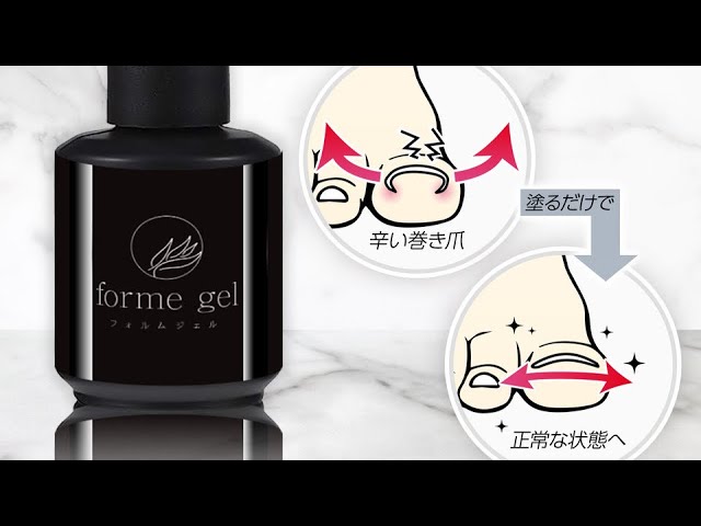 フォルムジェル使い方 巻き爪を緩和して正常な爪に！塗るだけ簡単巻き