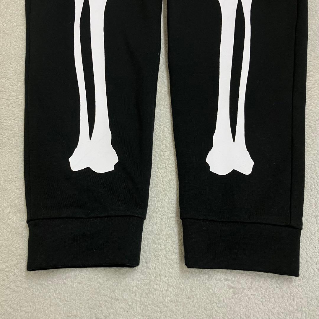 ベビーメタル BABYMETAL 骨パーカー＆パンツ セットアップ Mサイズ