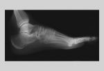Foot